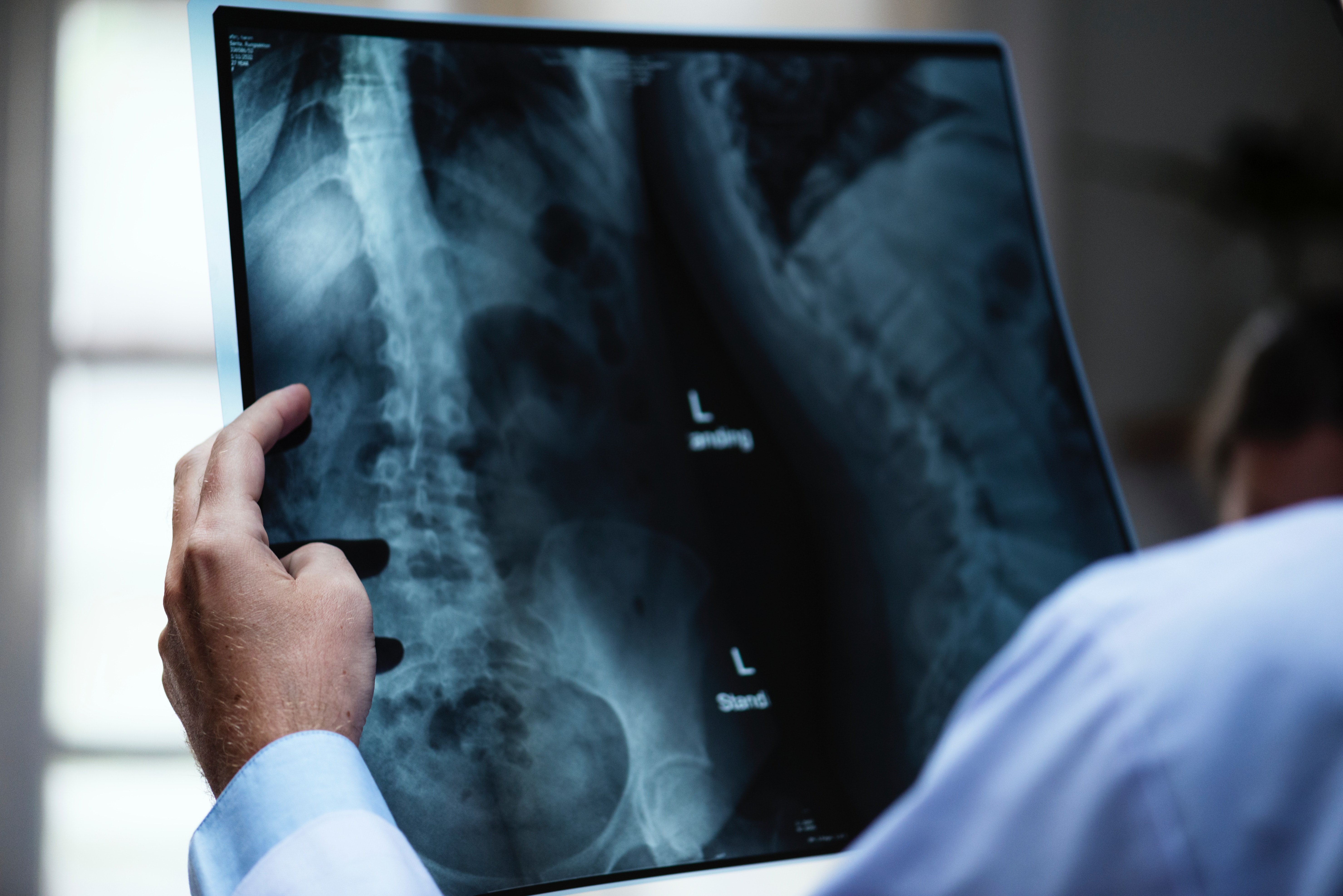 Hip Bursitis Pain